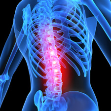 x-ray, medical, human body, skeleton, back