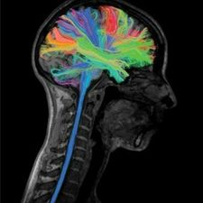 psychedelics, conversation, seniors 